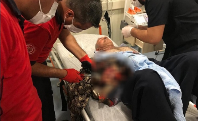 Şanlıurfa'da yaşlı adam elini makineye kaptırdı