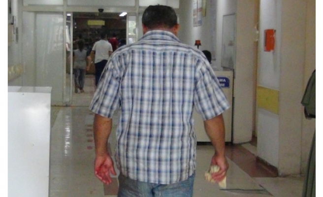 132 acemi kasap acile koştu