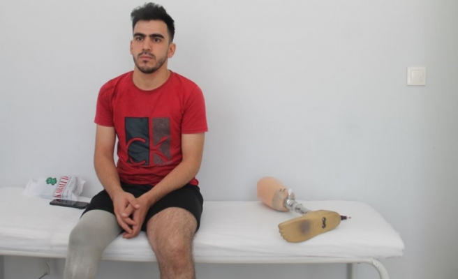 Urfa'da savaş mağdurlarına protez takılıyor