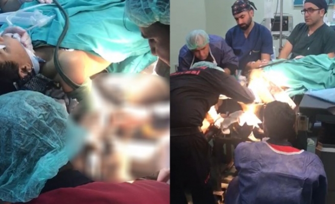 Şanlıurfa'da bir çocuk, elini et kıyma makinesine kaptırdı