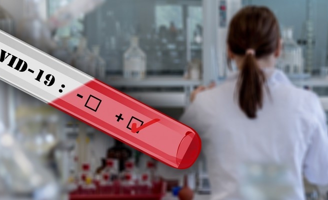 Koronavirüs testinin yapılabileceği hastaneler açıklandı
