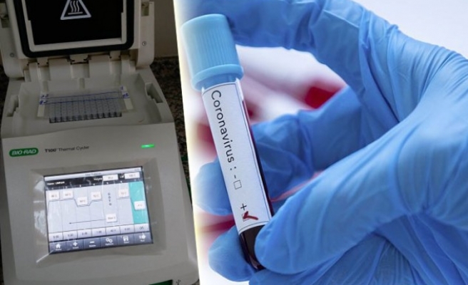 Urfa için test cihazı temin edildi ama 