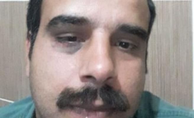 Urfa'da saldırıya uğradığı iddia edilen hekimle ilgili açıklama