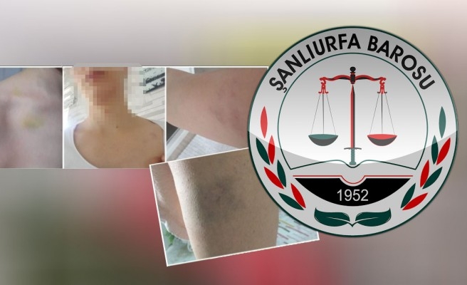 Urfa'da bir kadının çağrısı: Ölmek istemiyorum!