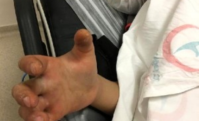 Urfa’da oyun oynayan çocuğu yılan soktu