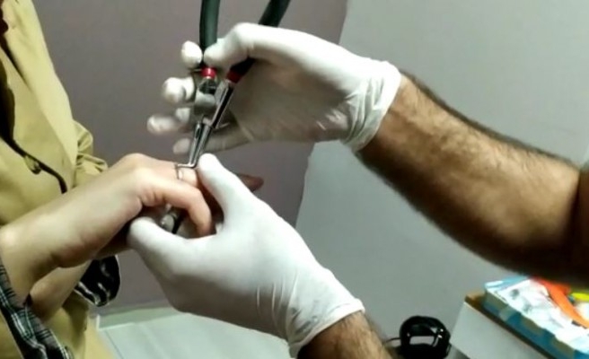 Parmağına yüzük sıkışan kadının imdadına itfaiye yetişti