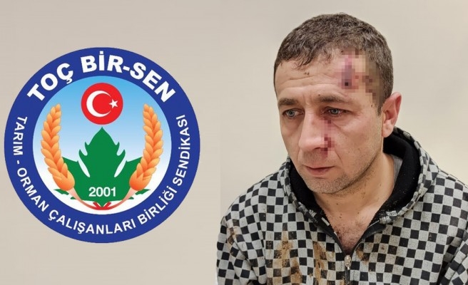 Şanlıurfa'da yaralanan veteriner hekim ile ilgili basın açıklaması