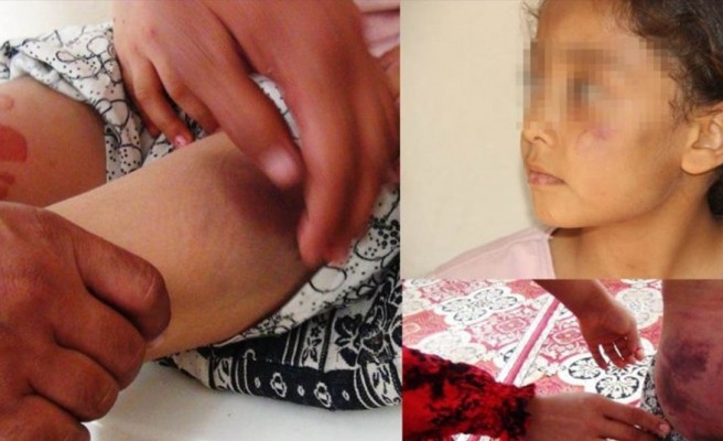 Şanlıurfa’da eşi ve çocuklarına işkence eden baba, tutuksuz olarak yargılanacak