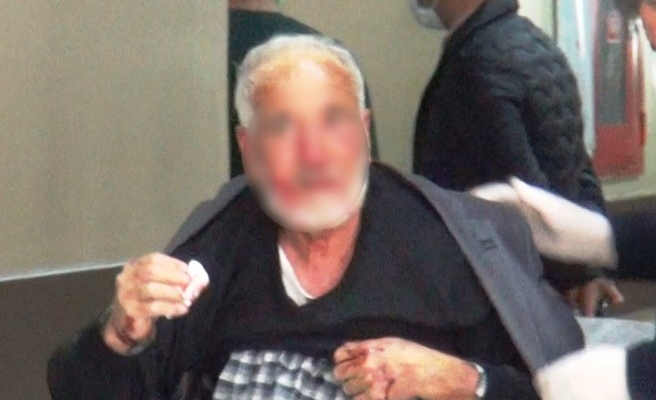 Şanlıurfa'da köpeğin saldırdığı adam yaralandı