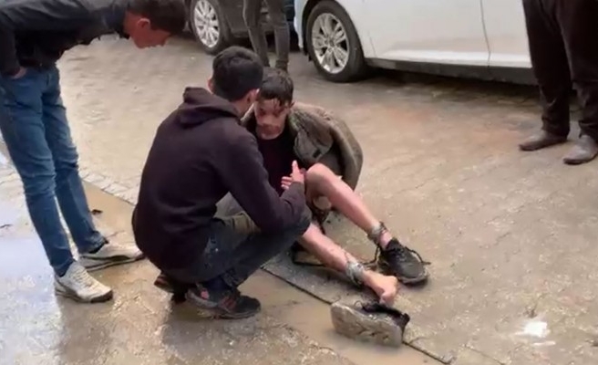Şanlıurfa'da tinerle ısınmak isteyen bir kişi yaralandı