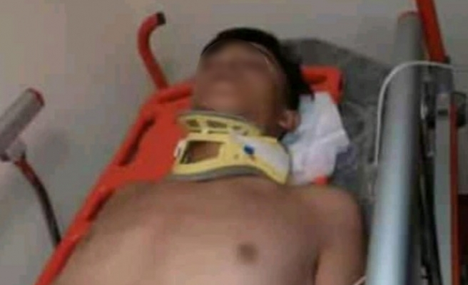 Suya atlarken beton zemine çarptı