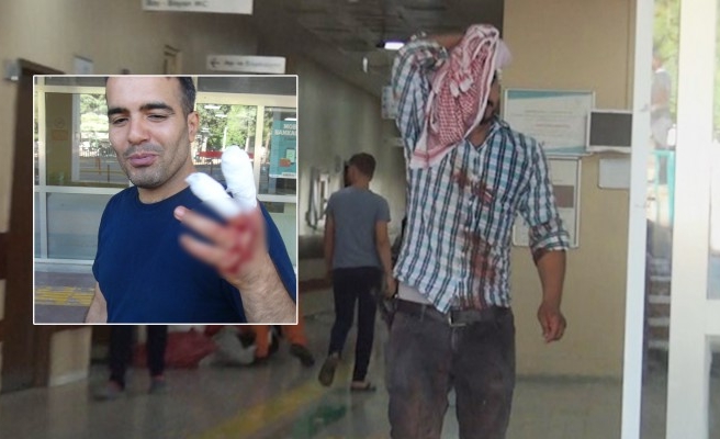 Şanlıurfa’da acemi kasaplar hastanelik oldu