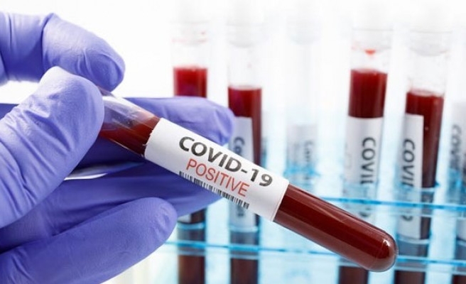 Bayram ziyaretine geldiler, korona oldukları ortaya çıktı!