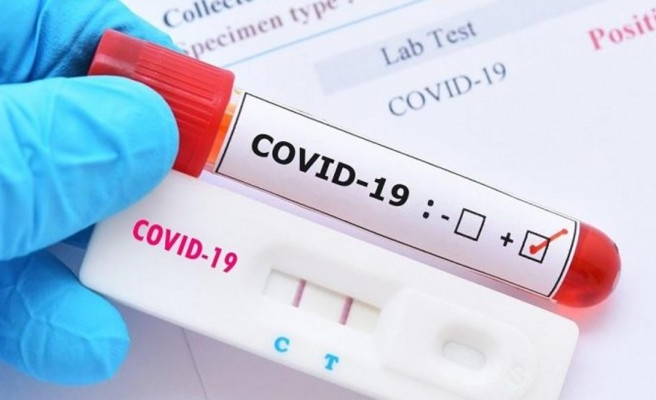 PCR testi pozitif olan tarım işçisi, Kırıkkale’de çevirmeye takıldı