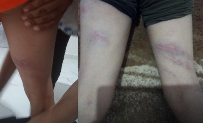 Şanlıurfa’da küçük çocuğa işkence iddiası