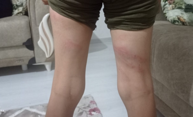 11 yaşındaki çocuğa dehşeti yaşattı: Elektrik kablolu işkence!