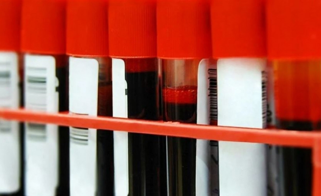 Kan grupları sağlığa dair ipuçları veriyor