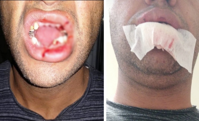 Aşı yaparken, inek darbesi aldı