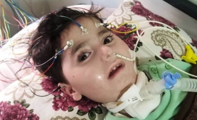 SMA hastası Abdullah yaşam mücadelesi veriyor