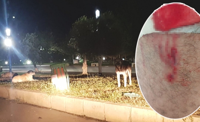 Şanlıurfa'da 3 kişi köpeklerin saldırısına uğradı