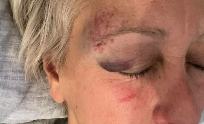 Klaus Schmidt’in eşinden komşusu hakkında hem darp hem gasp iddiası!