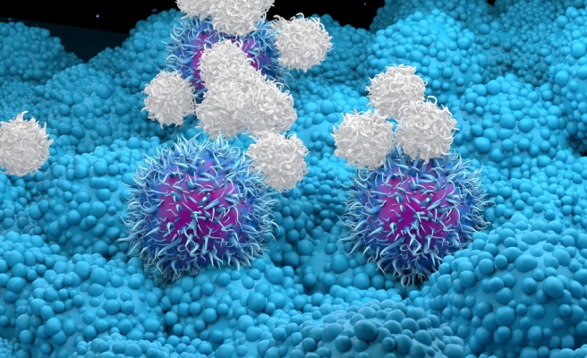 Pankreas kanseri riskini artıran etkenler