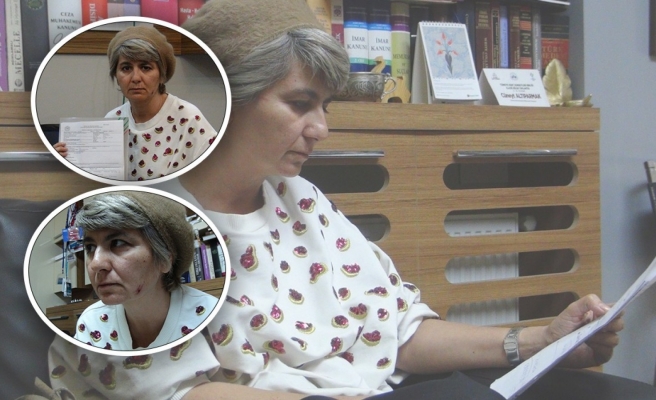 Alman arkeolog Schmidt'in eşinin darp edilmesinde yeni iddia!