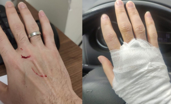 Urfa'da sağlık çalışanına darp!