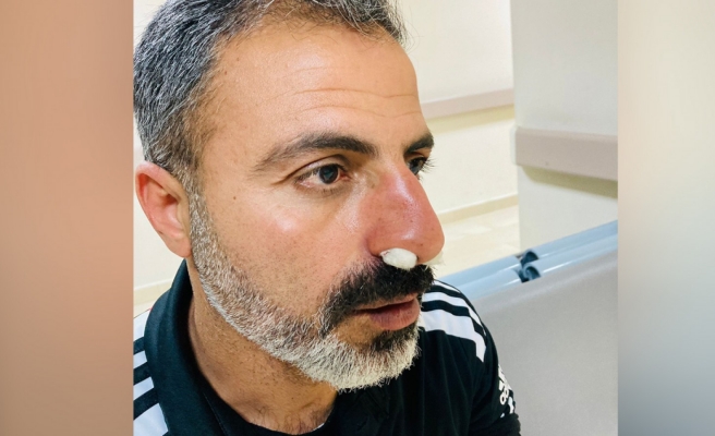 Karaköprü Belediyespor personeline saldırı