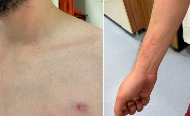 Şanlıurfa'da doktorun darp edilmesine tepki!