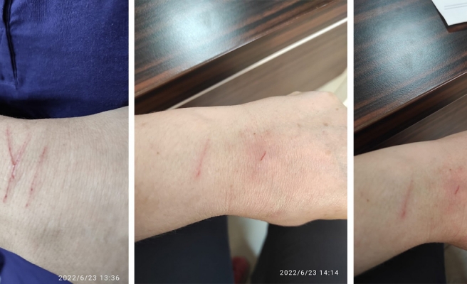 Urfa’da sağlık çalışanları şiddete uğradı!