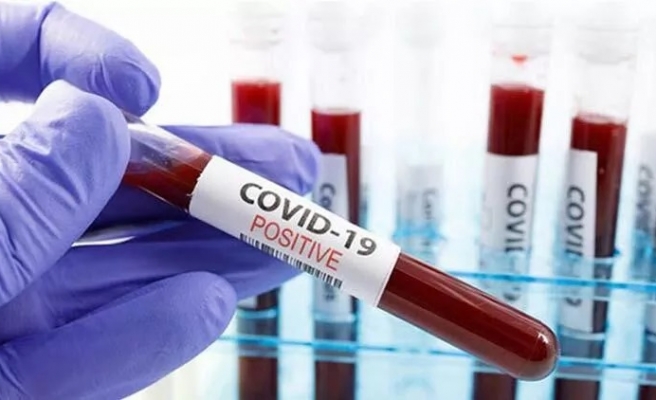 Haftalık koronavirüs tablosu açıklandı!