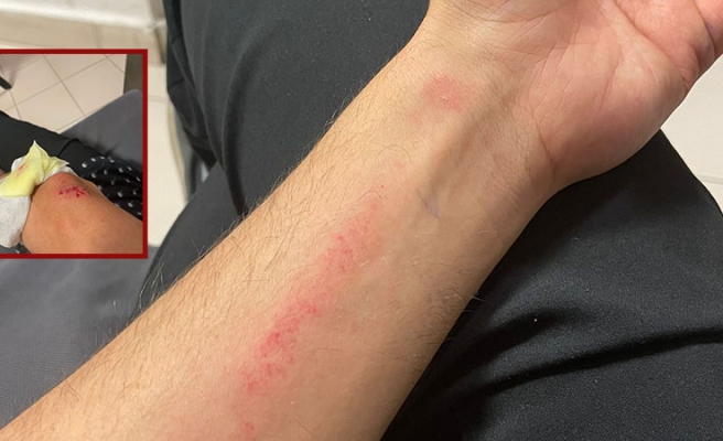 Urfa’da bu kez sağlık çalışanları doktoru darp etti!