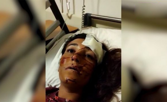 Eyyübiye’de takip edilen kadına araç çarptı