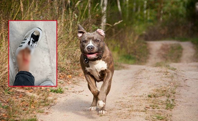 Urfa polisi 17 yaşındaki çocuğa saldıran pitbullun sahibini arıyor