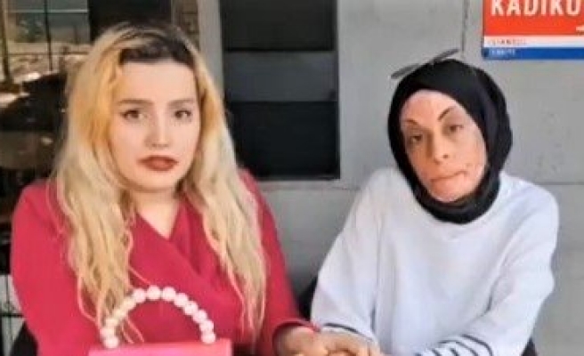 Şanlıurfa’da çocukken çıkan yangında yüzü yanan kadın destek bekliyor