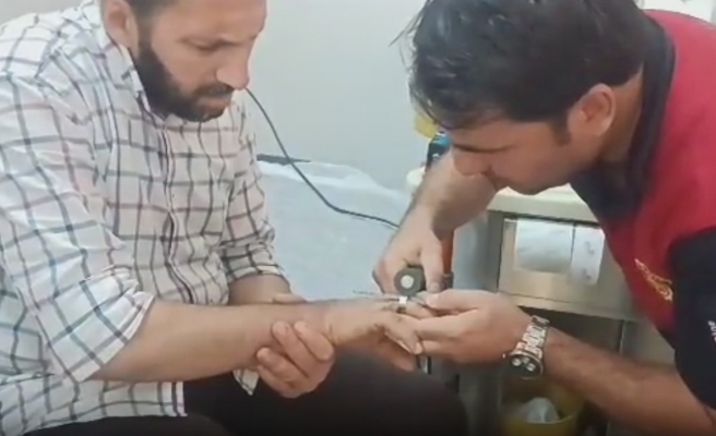 Parmağına sıkışan yüzüğü itfaiye ekipleri çıkardı