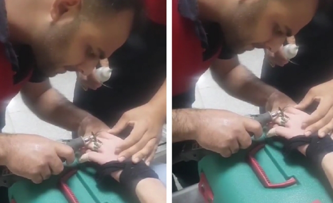 Şanlıurfa'da bir kişinin parmağına sıkışan yüzüğü itfaiye çıkardı