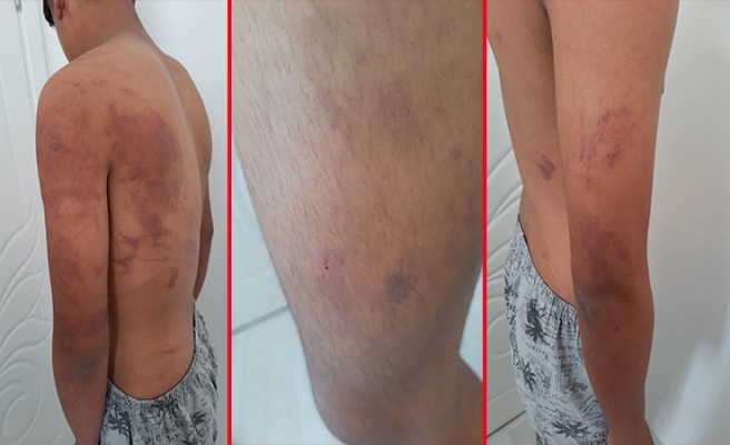 Urfa’da babası ve amcası tarafından 15 yaşındaki çocuğa işkence iddiası