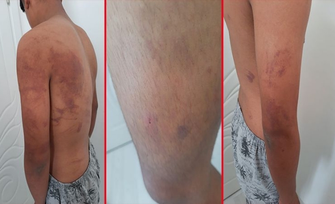 Urfa’da zincirle işkence iddiasında baba ve amca tutuklandı