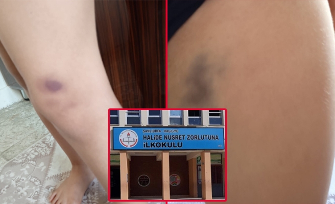 Urfa’da ilkokulda oğlu darp edilen anne şikayetçi oldu