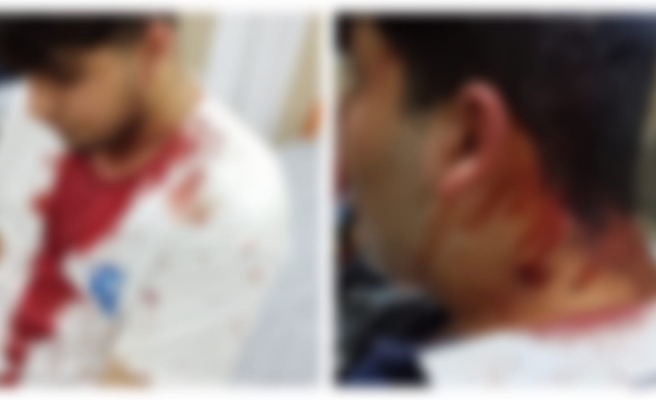 Urfa’da sokak ortasında sopalı kavga