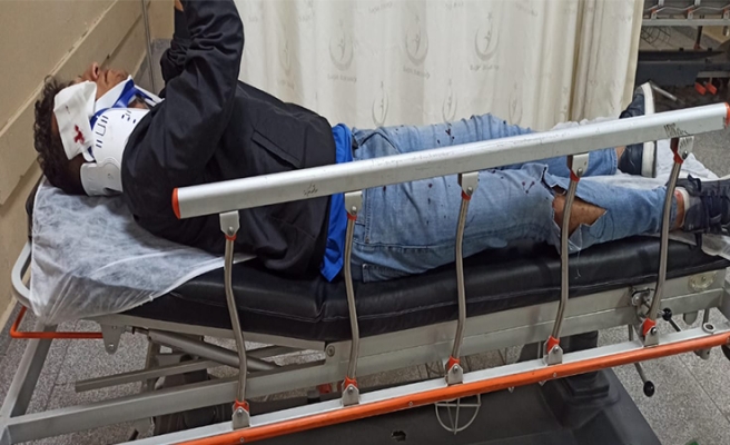 Urfa’da motosiklet sürücüsü hastanelik oldu
